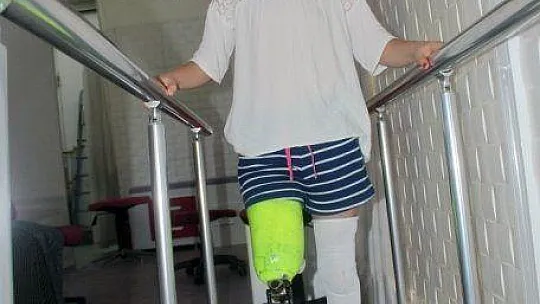 Aylin'in protez bacak sevinci