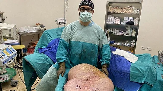 Bedeninden tam 35 kiloluk kitle çıktı