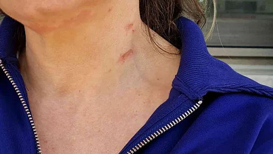 Bodrum'da dehşet anları
