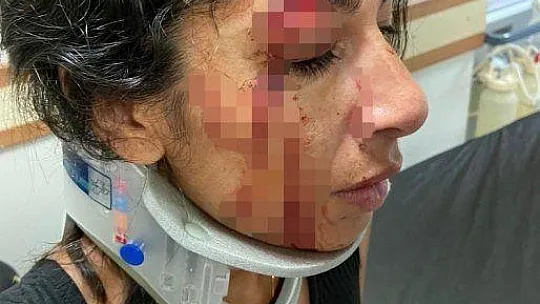 Bodrum'da kadınlar birbirine girdi