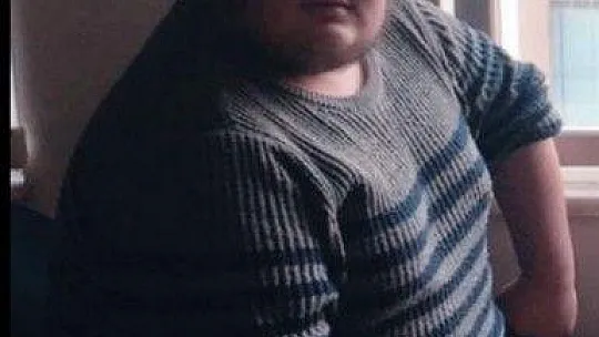 Dolmuşta oturduğu koltuğu kırınca 77 kilo zayıfladı