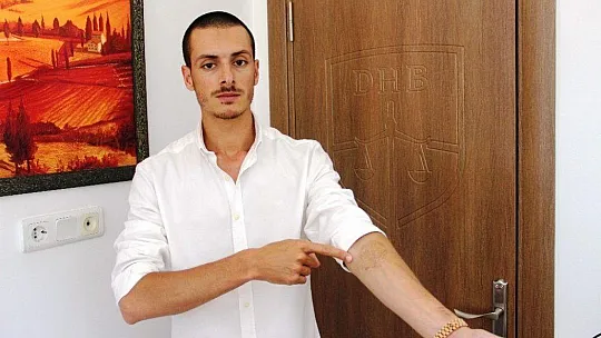 Hayalleri için sildirmek istediği dövmeler kabusu oldu
