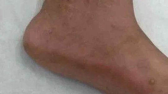 Karşılıklı husumet aileleri dağıttı