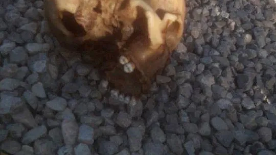 Köpeğin getirdiği insan kafatası polisi alarma geçirdi