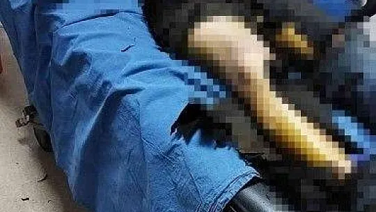Marmaris'te kendini yakan kömürcü hayatını kaybetti