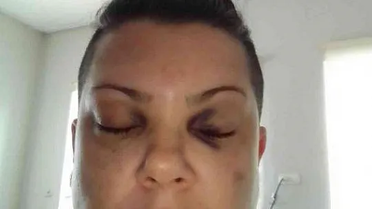 ŞARKICI MEVLANAOĞLU, EVİNİN ÖNÜNDE DARP EDİLDİ