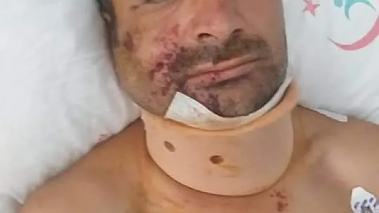 İlk sorduğu şey, 'Sönmeyen yangın var mı?