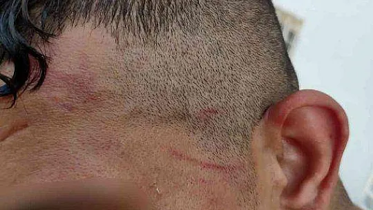 YUNANİSTAN'IN İNSANLIK SUÇU KARNESİ