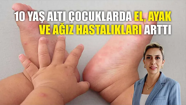 10 yaş altı çocuklarda el, ayak ve ağız hastalıkları arttı