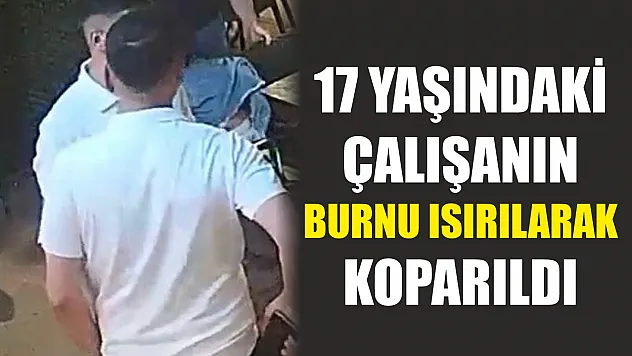 17 yaşındaki çalışanın burnu ısırılarak koparıldı