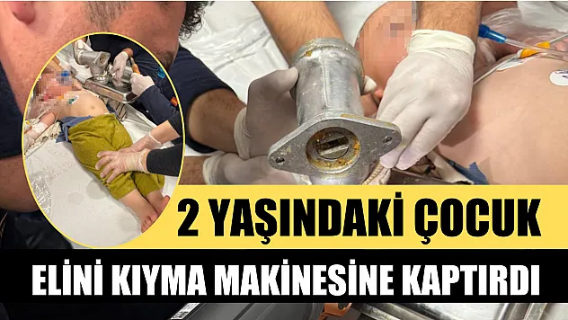 2 yaşındaki çocuk elini kıyma makinesine kaptırdı
