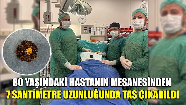 80 yaşındaki hastanın mesanesinden 7 santimetre uzunluğunda taş çıkarıldı
