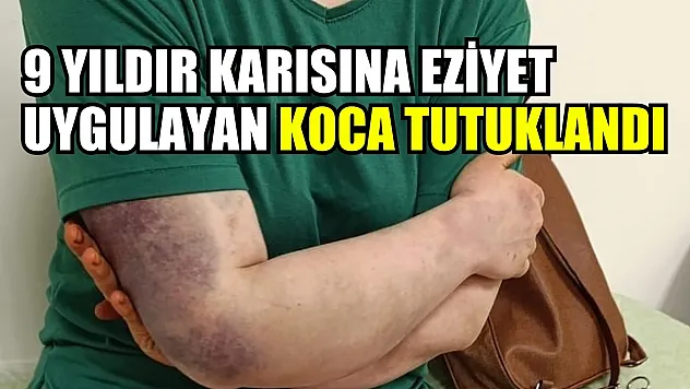 9 yıldır karısına eziyet uygulayan koca tutuklandı