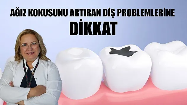 Ağız kokusunu artıran diş problemlerine dikkat