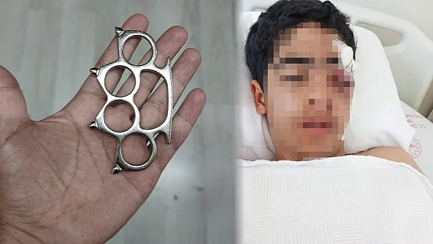 Akran zorbalığına bir yenisi eklendi: 15 yaşındaki çocuk muştayla öldüresiye dövüldü