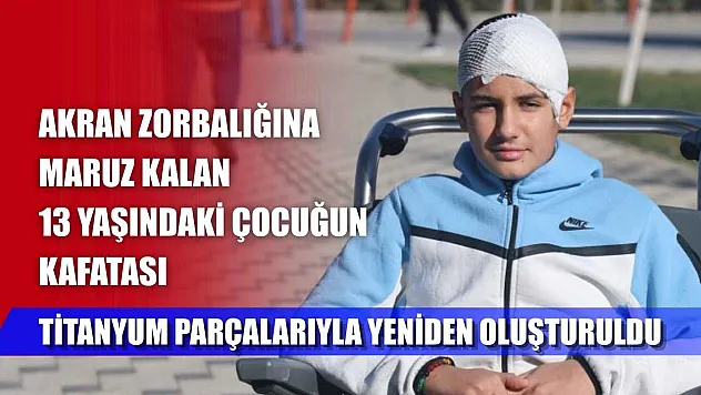 Akran zorbalığına maruz kalan 13 yaşındaki çocuğun kafatası titanyum parçalarıyla yeniden oluşturuldu