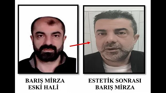 Ameliyat ile yüzünü değiştiren firari cinayet zanlısı, 7 yıl sonra yakalandı