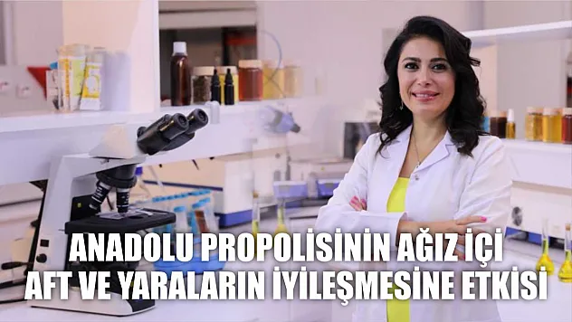 Anadolu propolisinin ağız içi aft ve yaraların iyileşmesine etkisi