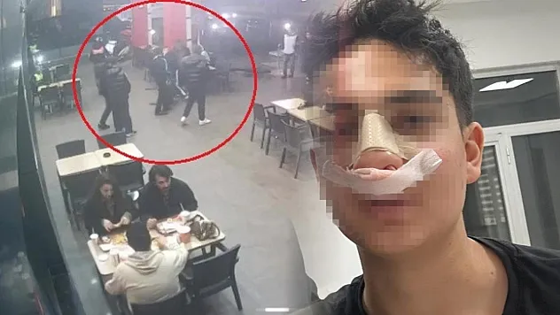 Antalya'da hiç tanımadıkları genci 'Neden bakıyorsun' diye darp edip burnunu kırdılar