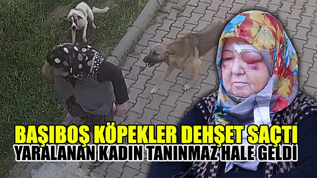 Başıboş Köpekler Dehşet Saçtı: Yaralanan Kadın Tanınmaz Hale Geldi