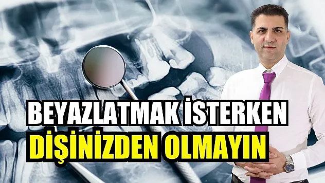 Beyazlatmak isterken dişinizden olmayın