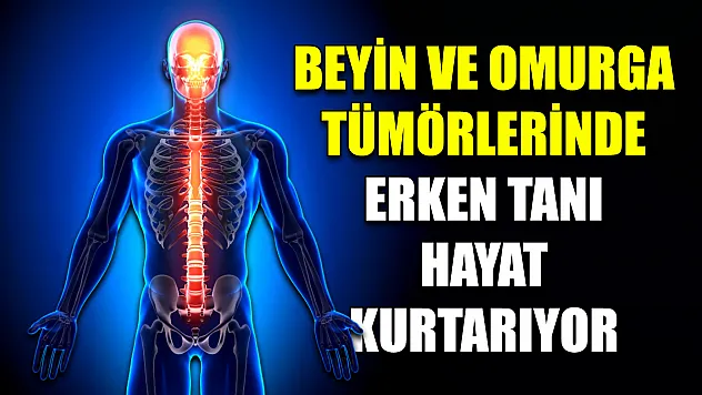 Beyin ve omurga tümörlerinde erken tanı hayat kurtarıyor