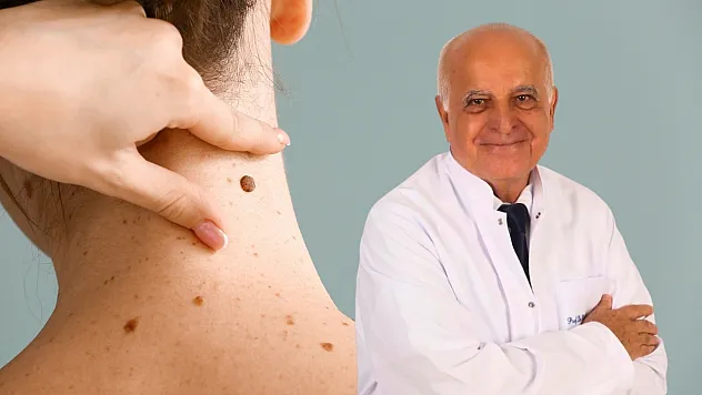 Bodrum'da Dermatoloji Uzmanı uyardı: Derideki masum görünen benlere dikkat