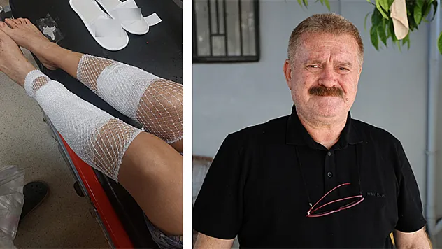 Çin Aslanı Evdeki Diğer Köpekten Sahibini Kıskanarak Bacağını Parçaladı