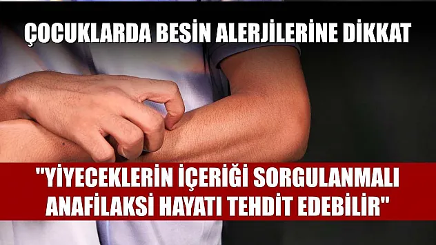 Çocuklarda besin alerjilerine dikkat: 'Yiyeceklerin içeriği sorgulanmalı, anafilaksi hayatı tehdit edebilir'