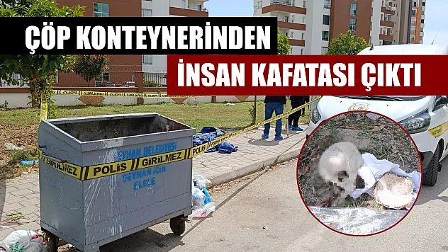 Çöp konteynerinden insan kafatası çıktı