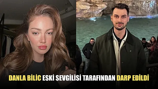 Danla Bilic eski sevgilisi tarafından darp edildi