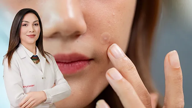 Dermatoloji Uzmanı Dr. Özsaraç: 'Yanlış alışkanlıklar cildi sessizce yıpratıyor'