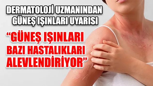 Dermatoloji Uzmanından Güneş Işınları Uyarısı