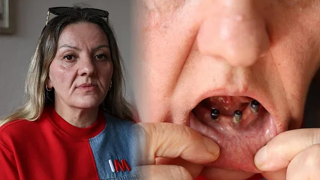 Diş ağrısı şikayetiyle gitti 25 dişinden oldu