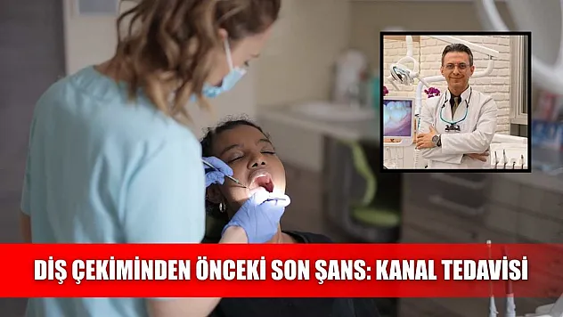 Diş çekiminden önceki son şans: Kanal tedavisi