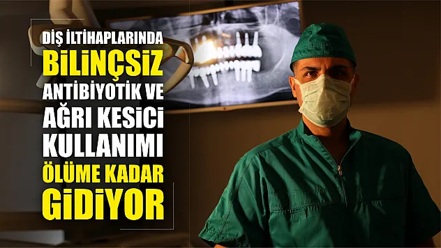 Diş iltihaplarında bilinçsiz antibiyotik ve ağrı kesici kullanımı ölüme kadar gidiyor