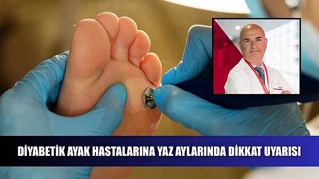 Diyabetik ayak hastalarına yaz aylarında dikkat uyarısı