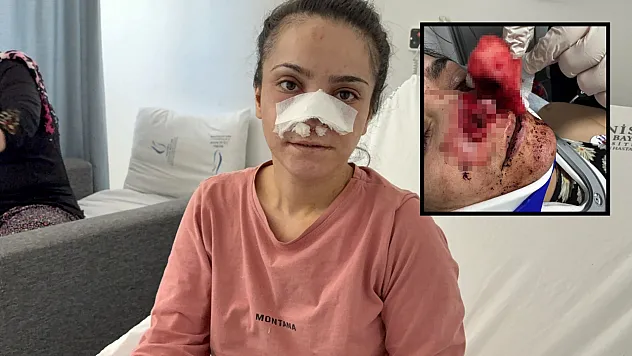Eşinin kopardığı burnu başarılı operasyonla yerine dikildi