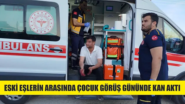 Eski eşlerin arasında çocuk görüş gününde kan aktı