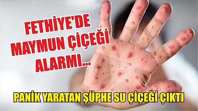 Fethiye'de Maymun Çiçeği Alarmı… Panik Yaratan Şüphe Su Çiçeği Çıktı