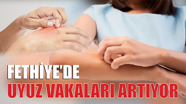 Fethiye'de Uyuz Vakaları Artıyor 