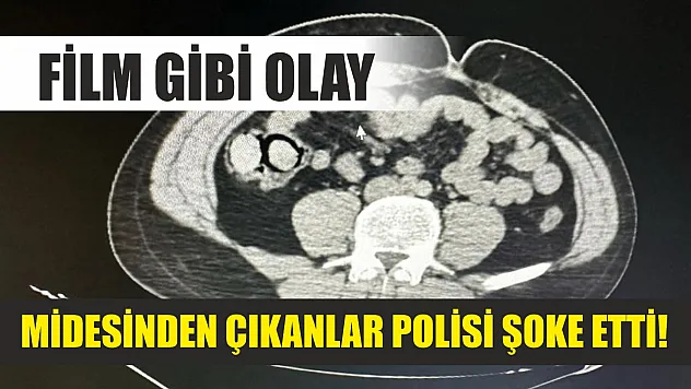 Film gibi olay: Midesinden çıkanlar polisi şoke etti!