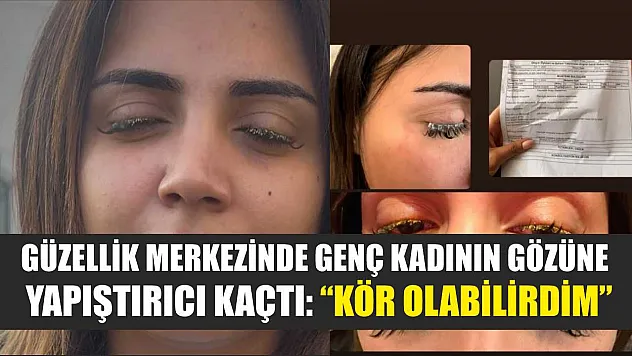Güzellik merkezinde genç kadının gözüne yapıştırıcı kaçtı: 'Kör olabilirdim'