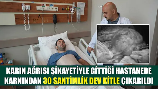 Karın ağrısı şikayetiyle gittiği hastanede karnından 30 santimlik dev kitle çıkarıldı