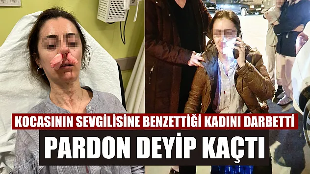 Kocasının sevgilisine benzettiği kadını darbetti, pardon deyip kaçtı