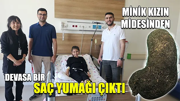Minik kızın midesinden devasa bir saç yumağı çıktı