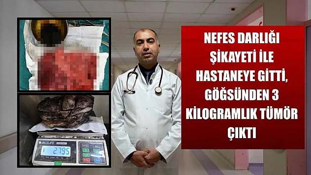 Nefes darlığı şikayeti ile hastaneye gitti, göğsünden 3 kilogramlık tümör çıktı