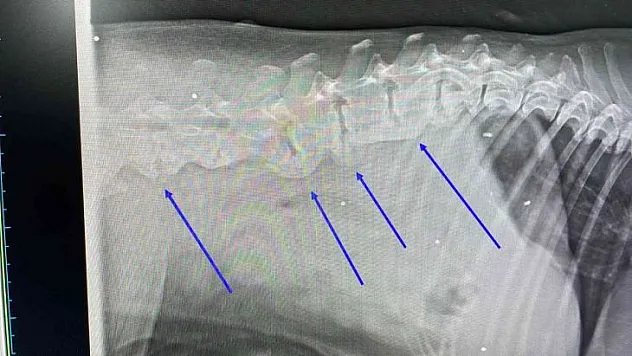 Vücudunda onlarca saçma ile yaşadığı ortaya çıktı