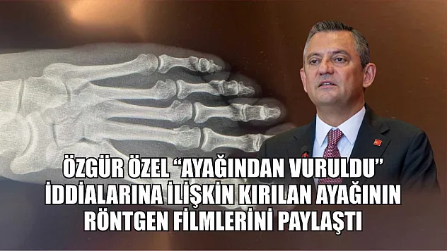 Özgür Özel 'ayağından vuruldu' iddialarına ilişkin kırılan ayağının röntgen filmlerini paylaştı