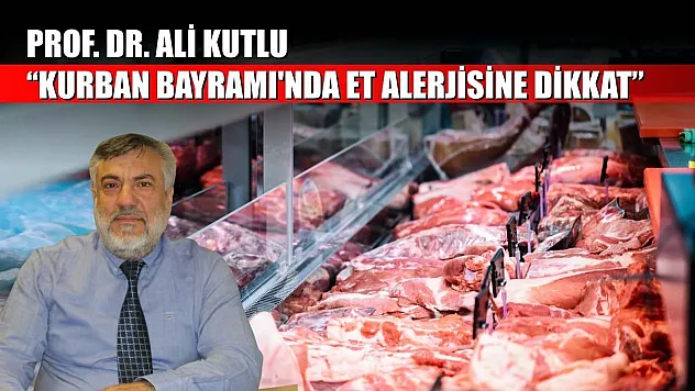 Prof. Dr. Ali Kutlu: 'Kurban Bayramı'nda et alerjisine dikkat'